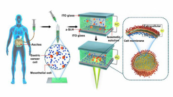 New method to help spot gastric cancer cells