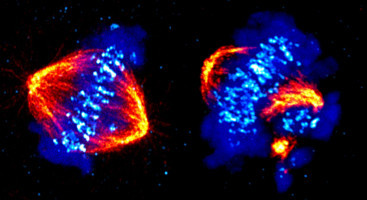 Los investigadores usan imágenes de células y modelos matemáticos para entender la progresión del cáncer