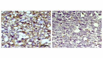 AI-driven study reports identifying (Z)-endoxifen as a potential therapeutic candidate for glioblastoma