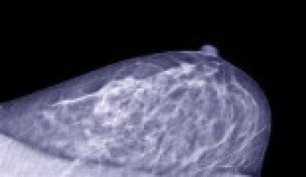 Inpatient mammograms can reduce disparities in breast cancer screening rates