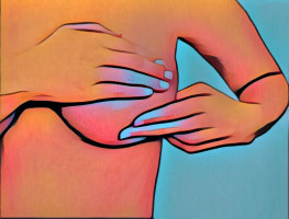 SABCS 2020: La dinámica del CTC puede predecir la respuesta al tratamiento y el pronóstico en pacientes con cáncer de mama metastásico.