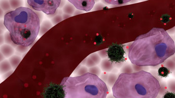 El tratamiento con calor puede hacer que la quimioterapia sea más eficaz