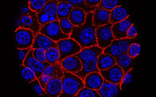 Pancreatic cancer tumours use multiple mechanisms to avoid starvation