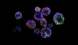 Creation of 3D organoid models to fine-tune radiation dose for nasopharyngeal cancer