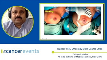 Round block technique ( Dr Piyush Mishra - All India Institute of Medical Sciences, New Delhi )