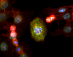Boosting cancer treatment: enhanced effectiveness of At-211-labeled agent achieved through combination with immunotherapy