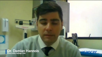 Tratamiento de inmunoterapia en el Cáncer de esófago avanzado ( Dr. Damian Hannois - Clínica Indisa, Santiago, Chile )