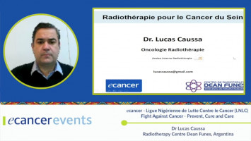 Forward Radiation Oncology in Breast cancer ( Dr Lucas Caussa - Dean Funes Medical Center, Argentina )