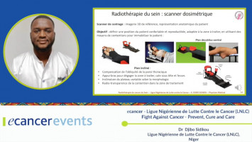 Breast cancer: Radiotherapy ( Dr Djibo Abdourahmane - Ligue Nigérienne de Lutte Contre le Cancer, Níger )