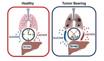 Loss of circadian regulation allows for increase in glucose production during lung cancer