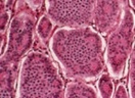 Visceral fat causally linked to intestinal cancer