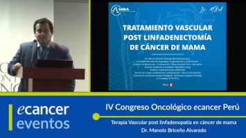 Terapia Vascular post linfadenopatía en cáncer de mama ( Dr. Manolo Briceño Alvarado - Clínica Internaciona, Perú )