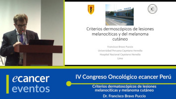 Criterios dermatoscópicos de lesiones melanocíticas y melanoma cutáneo ( Dr. Francisco Bravo Puccio - Universidad Peruana Cayetano Heredia, Perú )