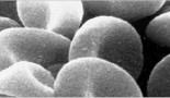 Cancer Research Technology and the Institute of Cancer Research enter collaboration with Janssen to discover multiple myeloma drug