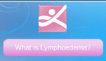 New phone app for breast cancer survivors with lymphoedema