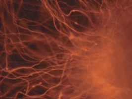 Protein that takes care of our DNA is critical to leukaemia