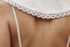 Non-melanoma skin cancer killing more people than melanoma
