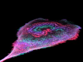'Power surges' on cancer cell membranes may fuel progression of disease