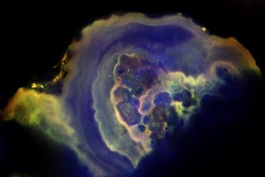 Beyond the mammogram: Study finds differences between benign and cancerous breast calcifications