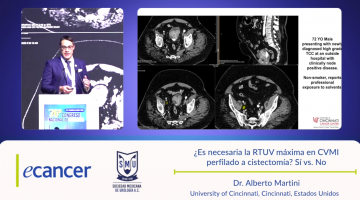 ¿Es necesaria la RTUV máxima en CVMI  perfilado a cistectomía? Sí vs. No ( Dr. Alberto Martini - University of Cincinnati (UC Health), Cincinnati, Estados Unidos )