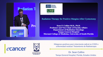 Márgenes positivos post cistectomía radical en CVMI o enfermedad residual: Tratamiento de Radioterapia ( Dr. Sean Collins - Tampa General Hospital, Florida, Estados Unidos )