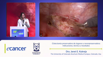 Cistectomía preservadora de órganos y neuropreservadora:  indicaciones, técnica y resultados ( Dr. Janet E. Kukreja - The University of Colorado Anschutz Medical Campus, Colorado, USA )
