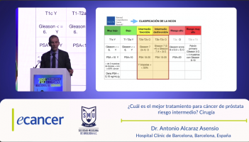 Estado del arte: linfadenectomía pélvica robótica radioguiada ( Dr. Antonio Alcaraz Asensio - Hospital Clínic de Barcelona, Barcelona, España )