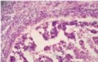 Los matemáticos doman el «ruido» celular para controlar la vida a nivel unicelular