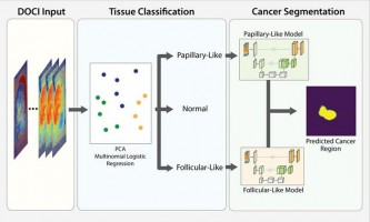 Una nueva perspectiva sobre el cáncer de tiroides: cuando la IA se une a las imágenes sin etiquetas en el quirófano