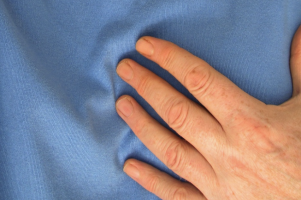 Los pacientes con hematopoyesis clonal tienen un mayor riesgo de padecer enfermedades cardíacas tras el tratamiento contra el cáncer.