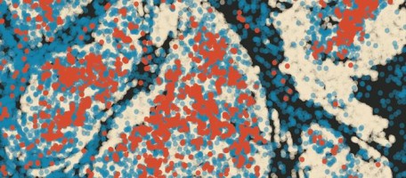 Immune 'hijacking' predicts cancer evolution