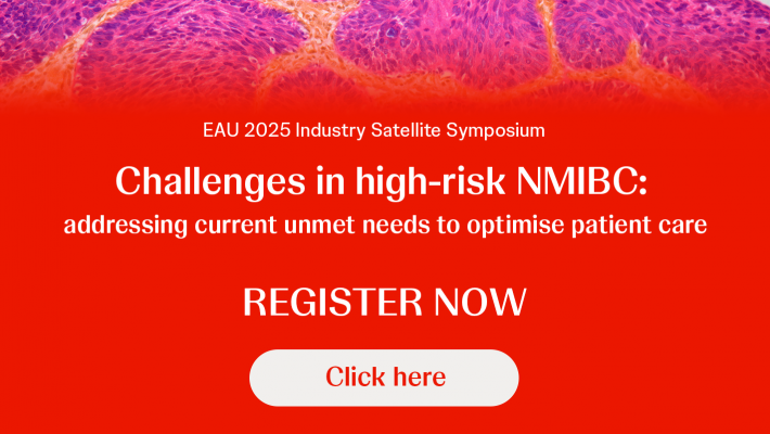 Free webinar: Challenges in high-risk NMIBC: addressing current unmet needs to optimise patient care