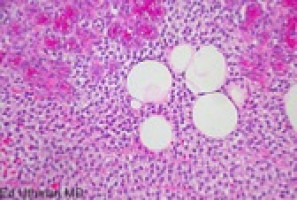 El CNIO reprograma el sistema CRISPR en ratones para eliminar células tumorales sin afectar a las células sanas