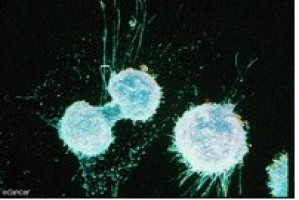 'Chase and run' cell movement mechanism explains metastasis