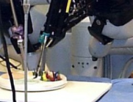 Robotic ultrasound gives surgeon more direct control in mapping and removing kidney cancers