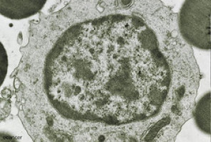 “Reprogrammed” treatment-resistant lymphomas respond to cancer drugs