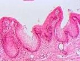 Senescent cancer cells: An Achilles’ heel for tumours