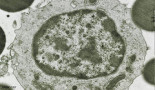 COMUNICADO: Cytocell Ltd introduce nuevas sondas hematológicas FISH para la leucemia linfocítica crónica (LLC)