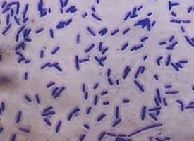 Investigadores desentrañan el importante papel de una proteína supresora de tumores en cáncer de mama