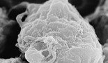 Una fusión espontánea con los macrófagos faculta a las células cancerígenas a propagarse